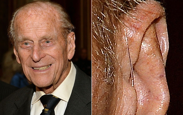 The Duke Of Edinburgh with Hearing Aid