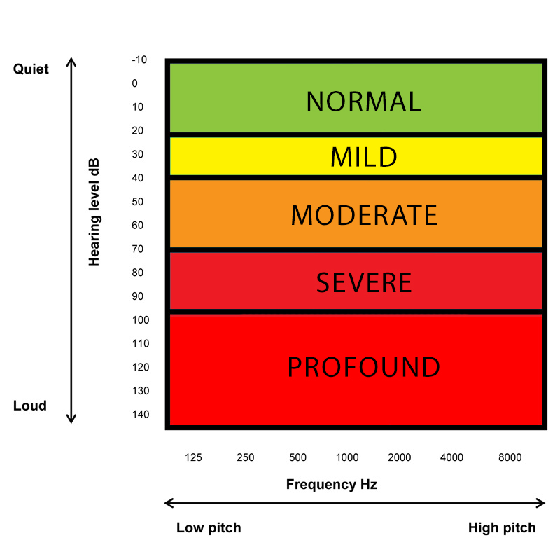 Audiograms explained hearing healthcare centre