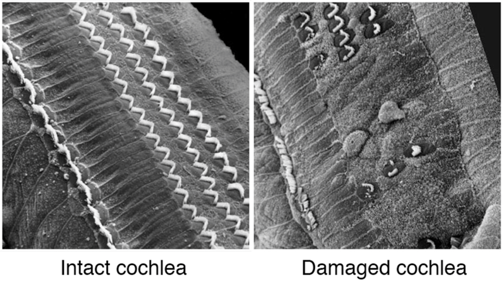 cochlear